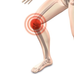 Knie-TEP (Knieprothese) » Ablauf, Risiken und Nachsorge