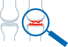 khws_web_medizin_arthrose-illutest01