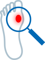 khws_web_medizin_illu_diabetischerfuss