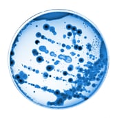 khws_web_medizin_lungenentzündung-petrischale